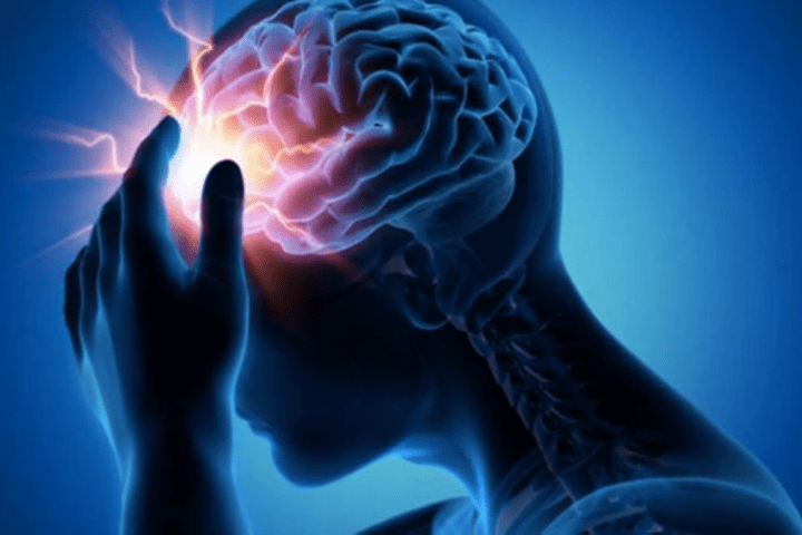 Epilepsia, ¿se puede prevenir?