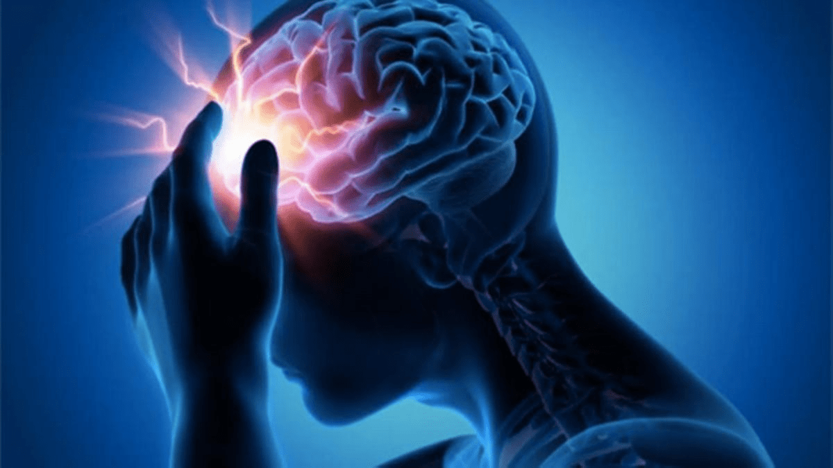 Epilepsia, ¿se puede prevenir?