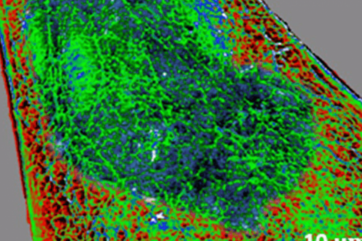 Científicos del Instituto de Ciencia de Materiales de Madrid (ICMM-CSIC) ha logrado un avance crucial en el ámbito de la nanomedicina.