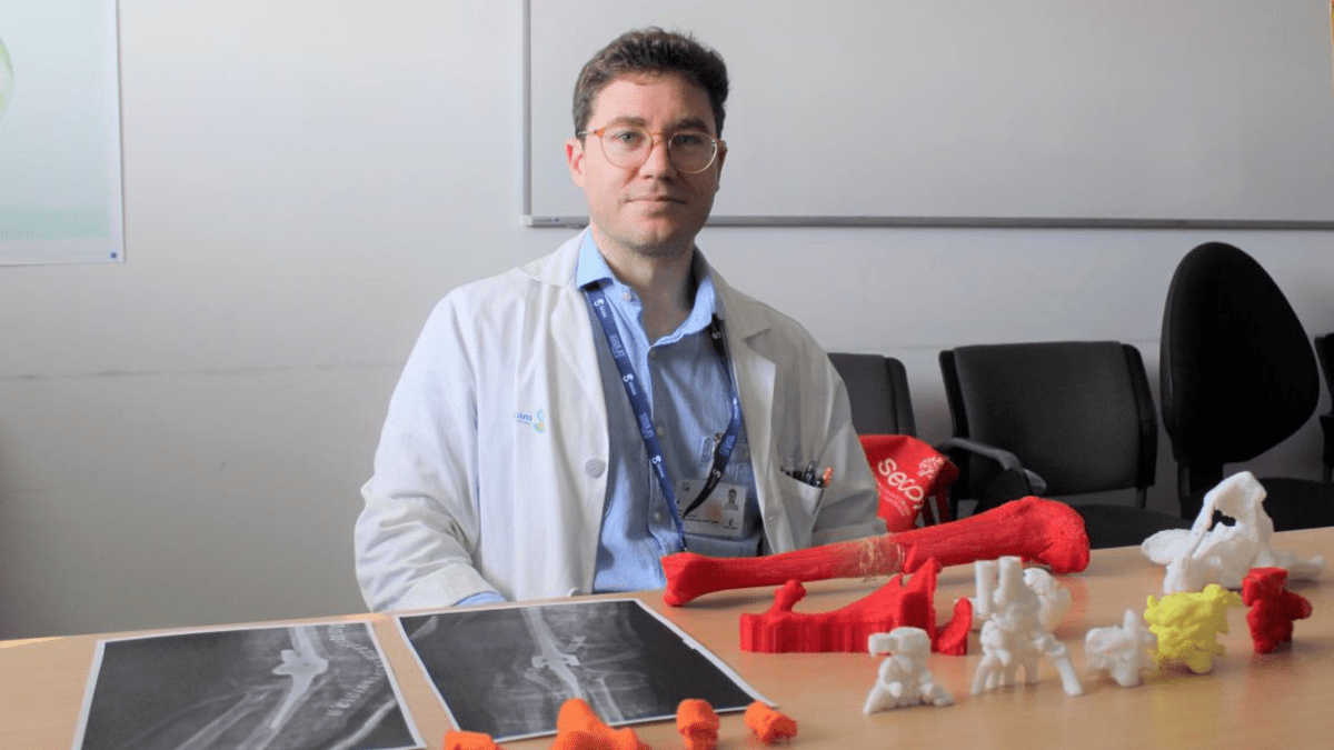 El Hospital De Ciudad Real Incorpora La Impresi n 3D