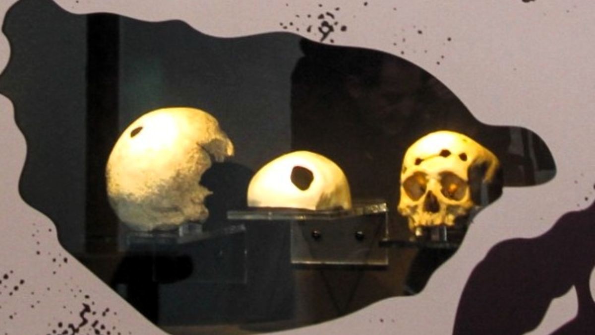 Cráneos humanos trepanados o cómo llegar al interior del cerebro