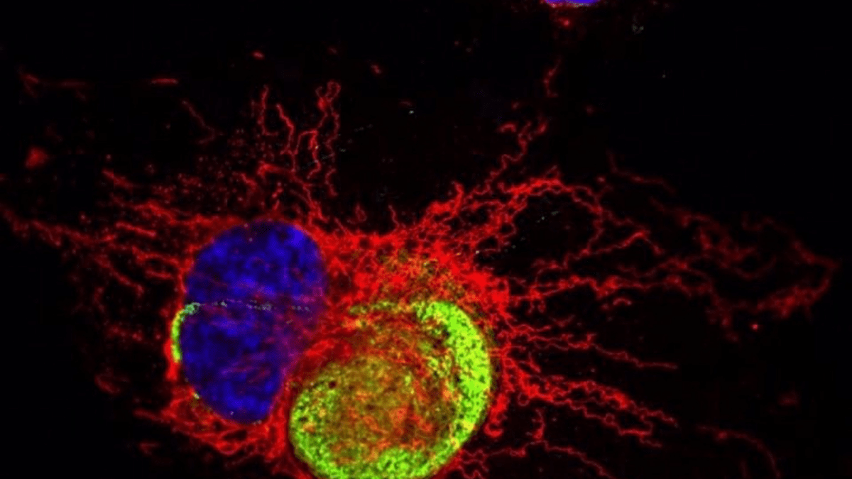 Investigación de la Universidad McMaster desafía percepciones sobre infecciones virales y salud cerebral.EP