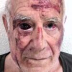 Detenidos los tgres autores de la brutal agresión al anciano de Torre Pacheco