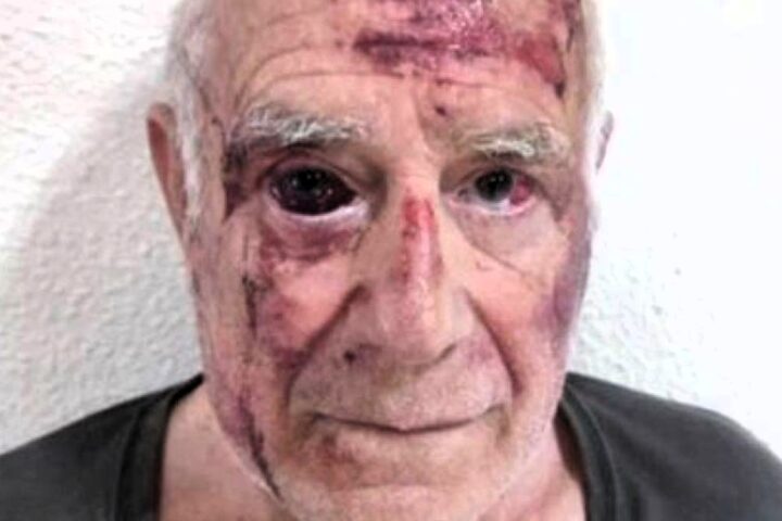 Detenidos los tgres autores de la brutal agresión al anciano de Torre Pacheco
