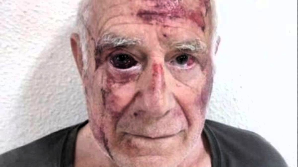 Detenidos los tgres autores de la brutal agresión al anciano de Torre Pacheco