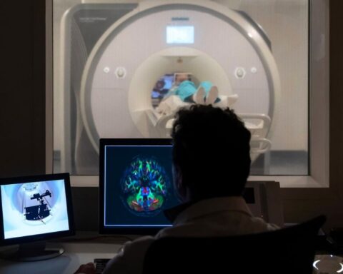 Un proyecto revolucionario devuelve el habla a personas que la han perdido por enfemedades como la ELA o lesiones neurológicas